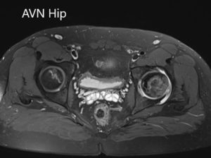 Axial sections of the T2WI