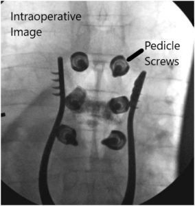 Intraoperative fluoroscopic images 4