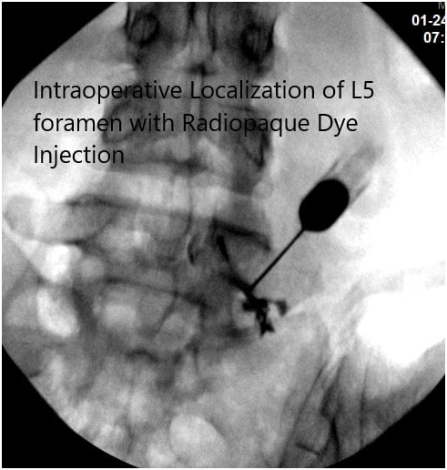 Intraoperative Fluoroscopy Images 2