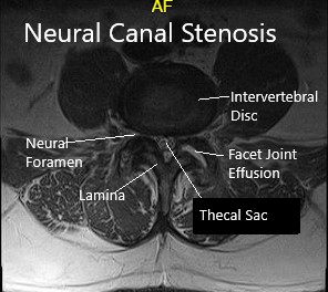 MRI showing sagittal and axial sections 2