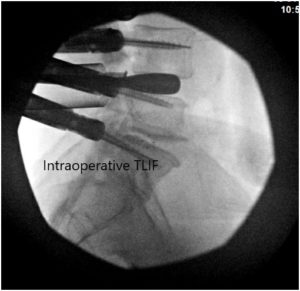 Intraoperative Fluoroscopic Images 2