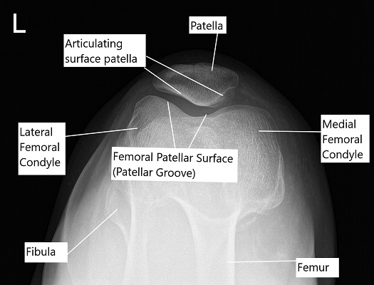 Skyline X-ray view of the patella.