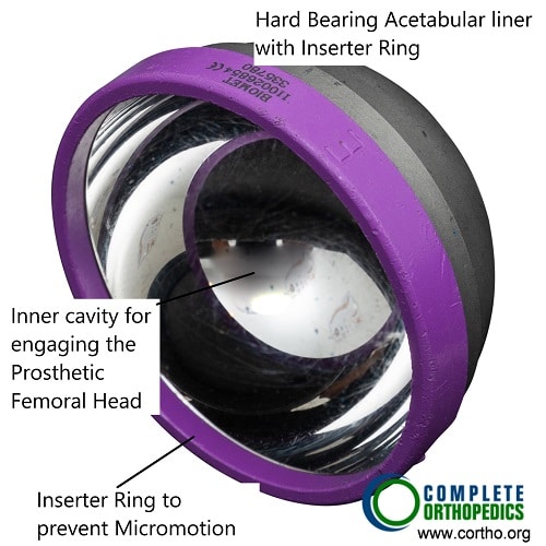 Revestimiento acetabular de rodamiento duro