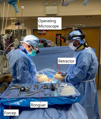 Imagen intraoperatoria de la cirugía de microdiscectomía lumbar.