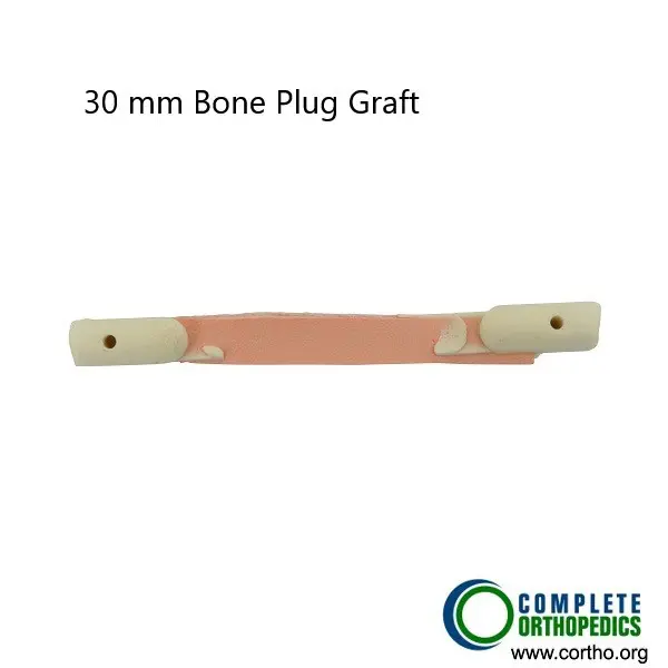 Bone plug graft used in ACL reconstruction.