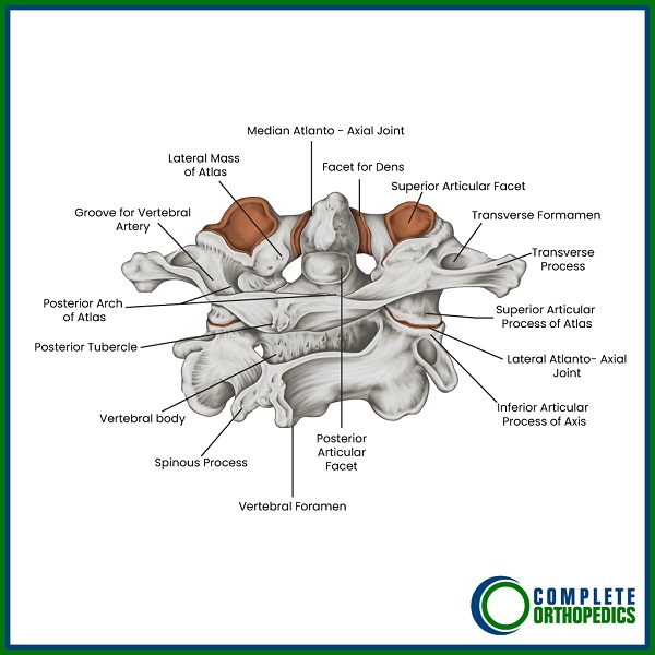 The Atlas (Top Bone in the Cervical Spine) Illustrated