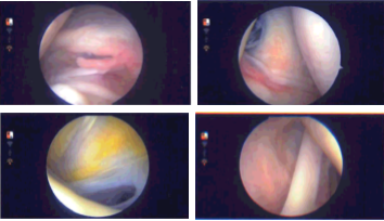 Intraoperative Arthroscopy Images