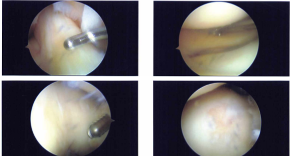 Intraoperative Images