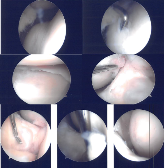 Intraoperative Images