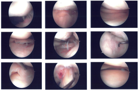 Intraoperative images