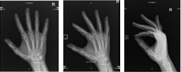 X-ray Right hand minimum 3 years