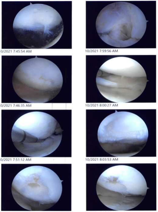 Intraoperative images