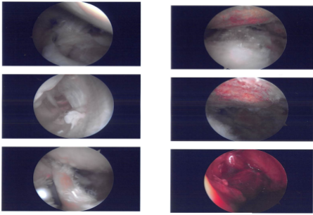 Intraoperative Images