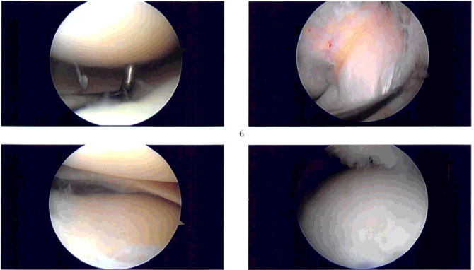 Intraoperative images